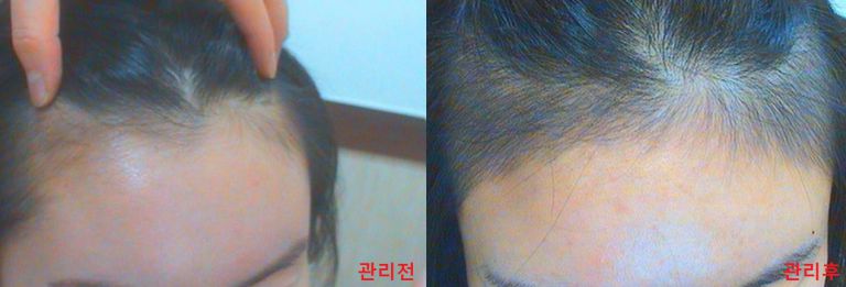 임상결과